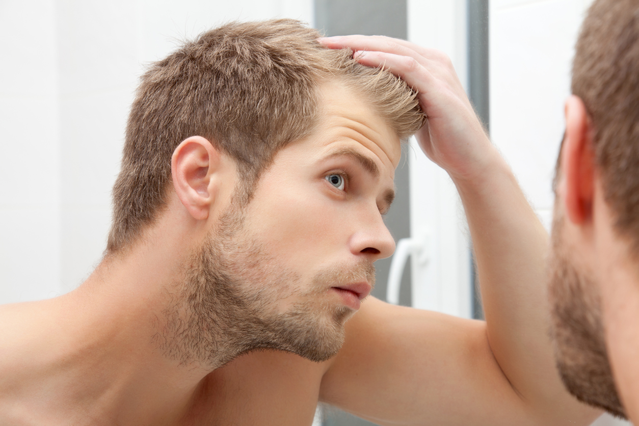Männer kurze haarausfall haare Haarausfall stoppen